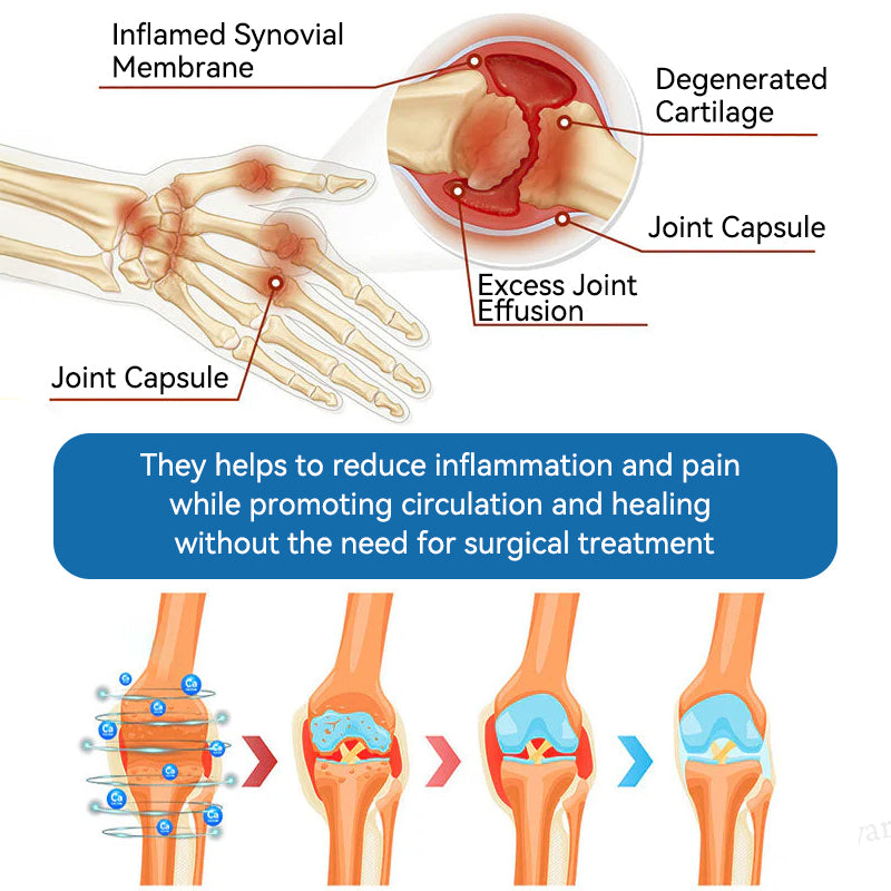 𝐁𝐏𝐂-𝟏𝟓𝟕 𝐉𝐨𝐢𝐧𝐭 𝐇𝐞𝐚𝐥𝐢𝐧𝐠 𝐂𝐫𝐞𝐚𝐦🦴Treats Arthritis, Neuropathy, Rheumatism, Sports Injuries & More🏆