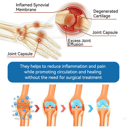 𝐁𝐏𝐂-𝟏𝟓𝟕 𝐉𝐨𝐢𝐧𝐭 𝐇𝐞𝐚𝐥𝐢𝐧𝐠 𝐂𝐫𝐞𝐚𝐦🦴Treats Arthritis, Neuropathy, Rheumatism, Sports Injuries & More🏆