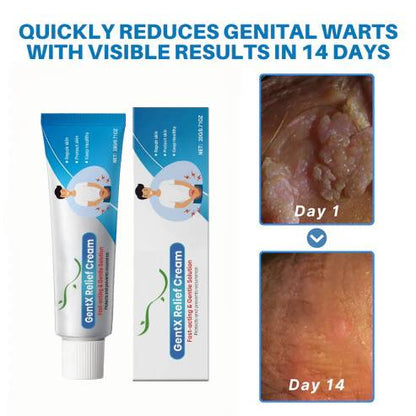 🌈🌞 Sale🌞🔥30 - Day Free Returns💰lirayn HPV Genital Warts Relief Cream🔥 - store