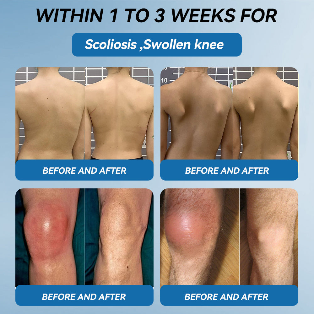 𝐁𝐏𝐂-𝟏𝟓𝟕 𝐉𝐨𝐢𝐧𝐭 𝐇𝐞𝐚𝐥𝐢𝐧𝐠 𝐂𝐫𝐞𝐚𝐦🦴Treats Arthritis, Neuropathy, Rheumatism, Sports Injuries & More🏆