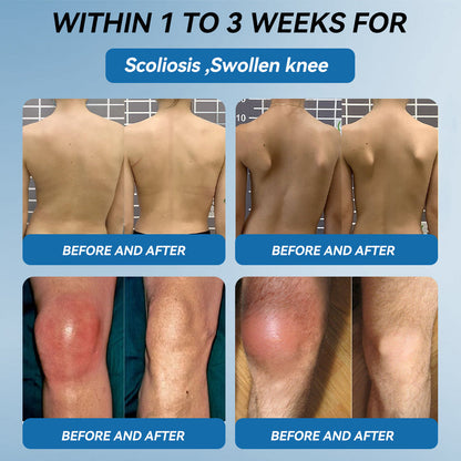 𝐁𝐏𝐂-𝟏𝟓𝟕 𝐉𝐨𝐢𝐧𝐭 𝐇𝐞𝐚𝐥𝐢𝐧𝐠 𝐂𝐫𝐞𝐚𝐦🦴Treats Arthritis, Neuropathy, Rheumatism, Sports Injuries & More🏆