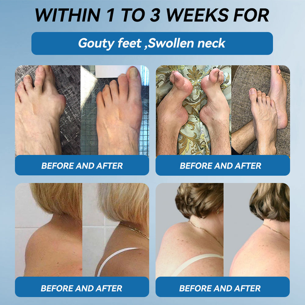 𝐁𝐏𝐂-𝟏𝟓𝟕 𝐉𝐨𝐢𝐧𝐭 𝐇𝐞𝐚𝐥𝐢𝐧𝐠 𝐂𝐫𝐞𝐚𝐦🦴Treats Arthritis, Neuropathy, Rheumatism, Sports Injuries & More🏆